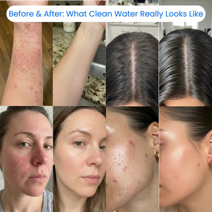 AQUALA Shower Filter